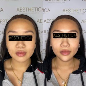 B&A - Facial Balancing