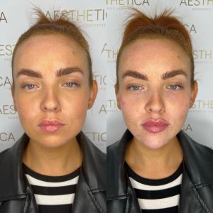 B&A - Facial Balancing x2
